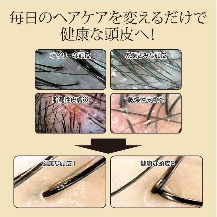 育毛シャンプー