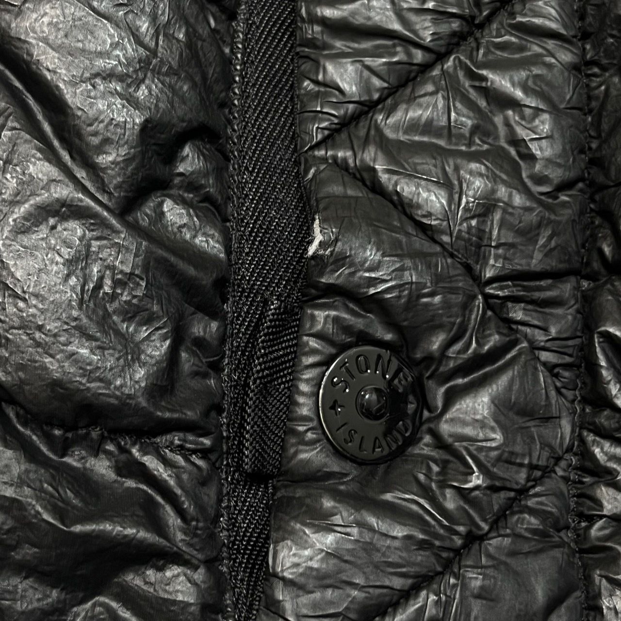 STONE ISLAND(ストーンアイランド) 00