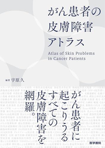 がん患者の皮膚障害アトラス 宇原 久