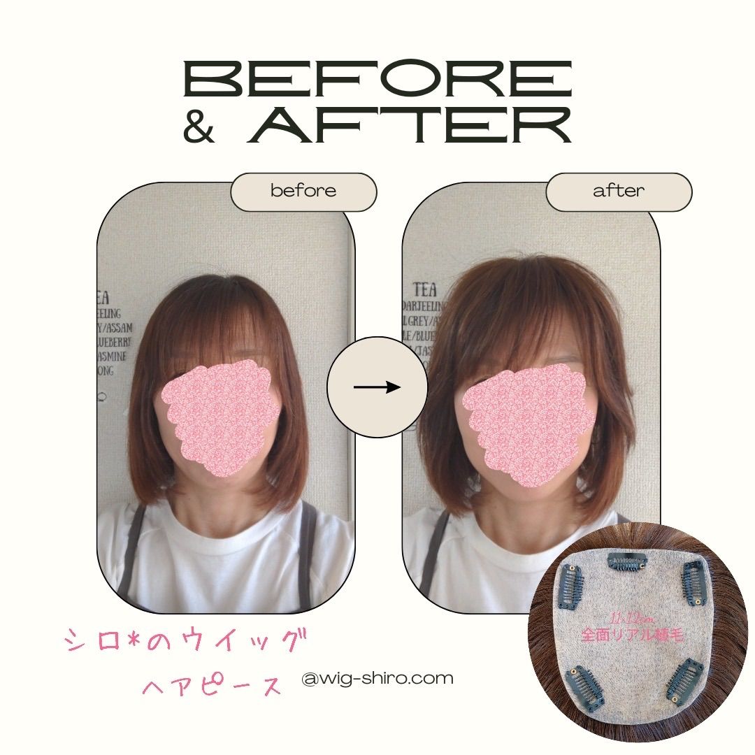 人毛レミー100%ヘアピース★ブラウン11×12☆20cmリアル植毛　薄毛隠し