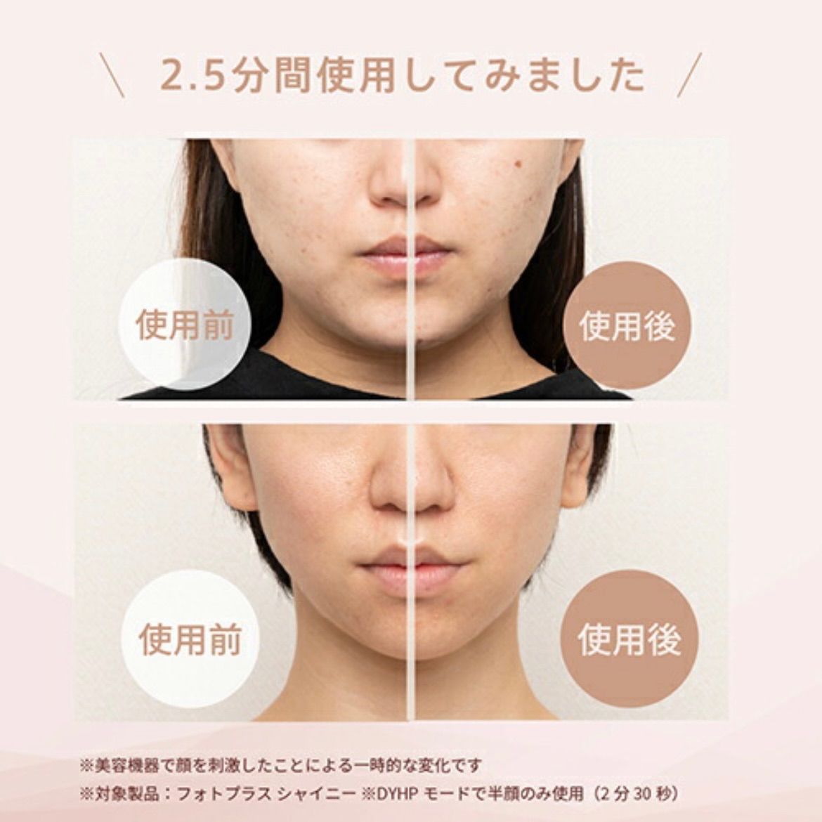 新品未使用】YA-MAN フォトプラスシャイニー RF美顔器 ヤーマンM18 
