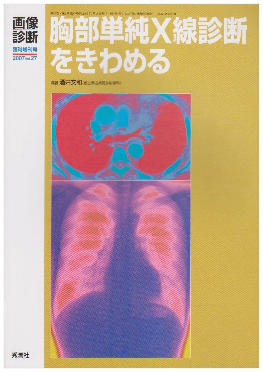 ♢裁断済 胸部の画像診断 胸部単純X線診断をきわめる (画像診断 07年臨時増刊号) - メルカリ