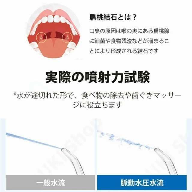 歯周ポケット 歯間