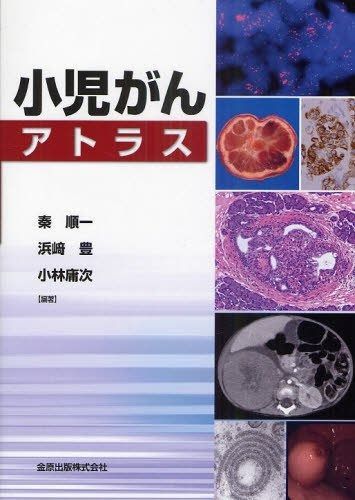 小児がんアトラス 本・雑誌・漫画 本 【公式通販】