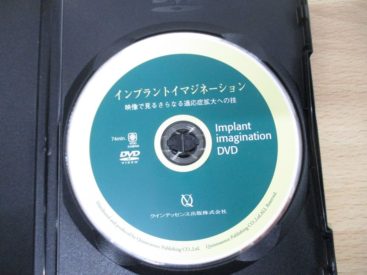 ○01)【同梱不可】インプラントイマジネーション DVD/映像で見る 