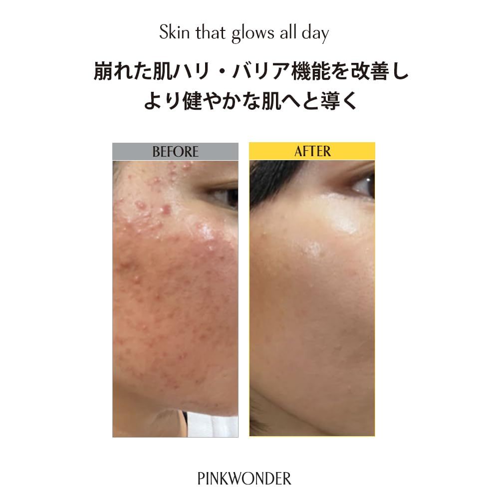 PINKWONDER ホホバ トナー 200ml ビタミンC ホホバオイル 化粧水 天然