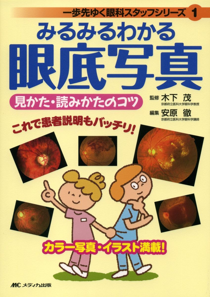 みるみるわかる眼底写真見かた・読みかたのコツ (一歩先ゆく眼科スタッフシリーズ 1)
