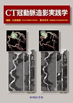 【中古-非常に良い】 CT冠動脈造影実践学