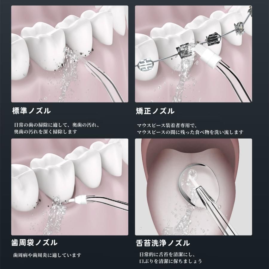 ジェットウォッシャー 口腔洗浄器 ウォーターピック 歯間ケア【歯科 熱