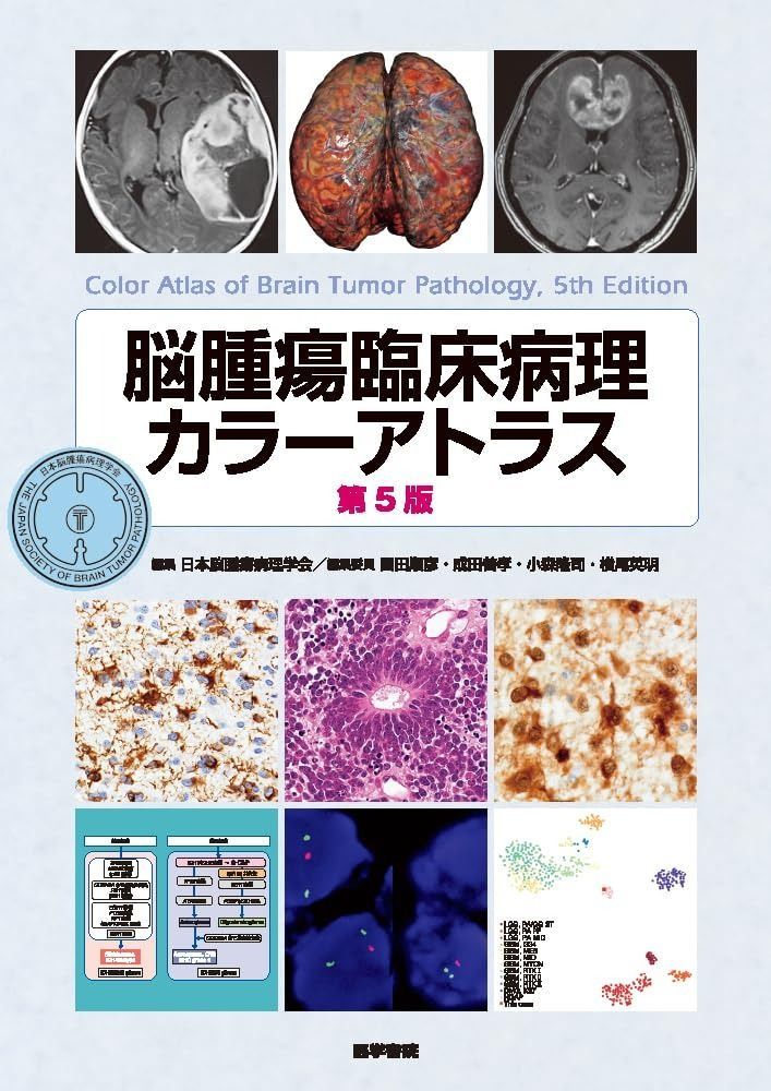 脳腫瘍臨床病理カラーアトラス 第5版