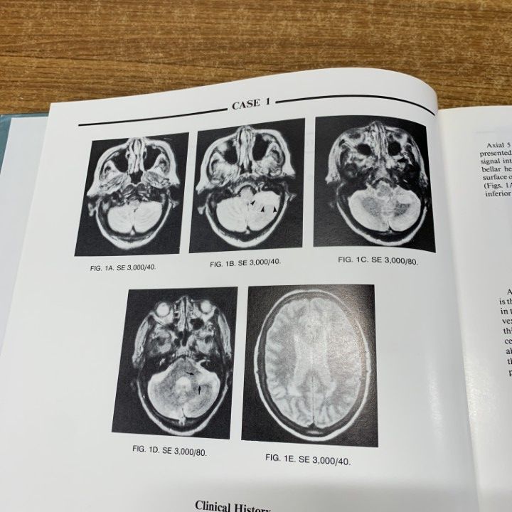 ▲01)【同梱不可】The Raven MRI Teaching File/10冊入り/Robert B Lufkin/Raven Press/MRI画像診断/医学/医療/洋書/B △01)【同梱不可】The Raven MRI Teaching File/10冊入り/Robert
