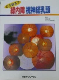 どう診る 緑内障視神経乳頭 洋一 井上