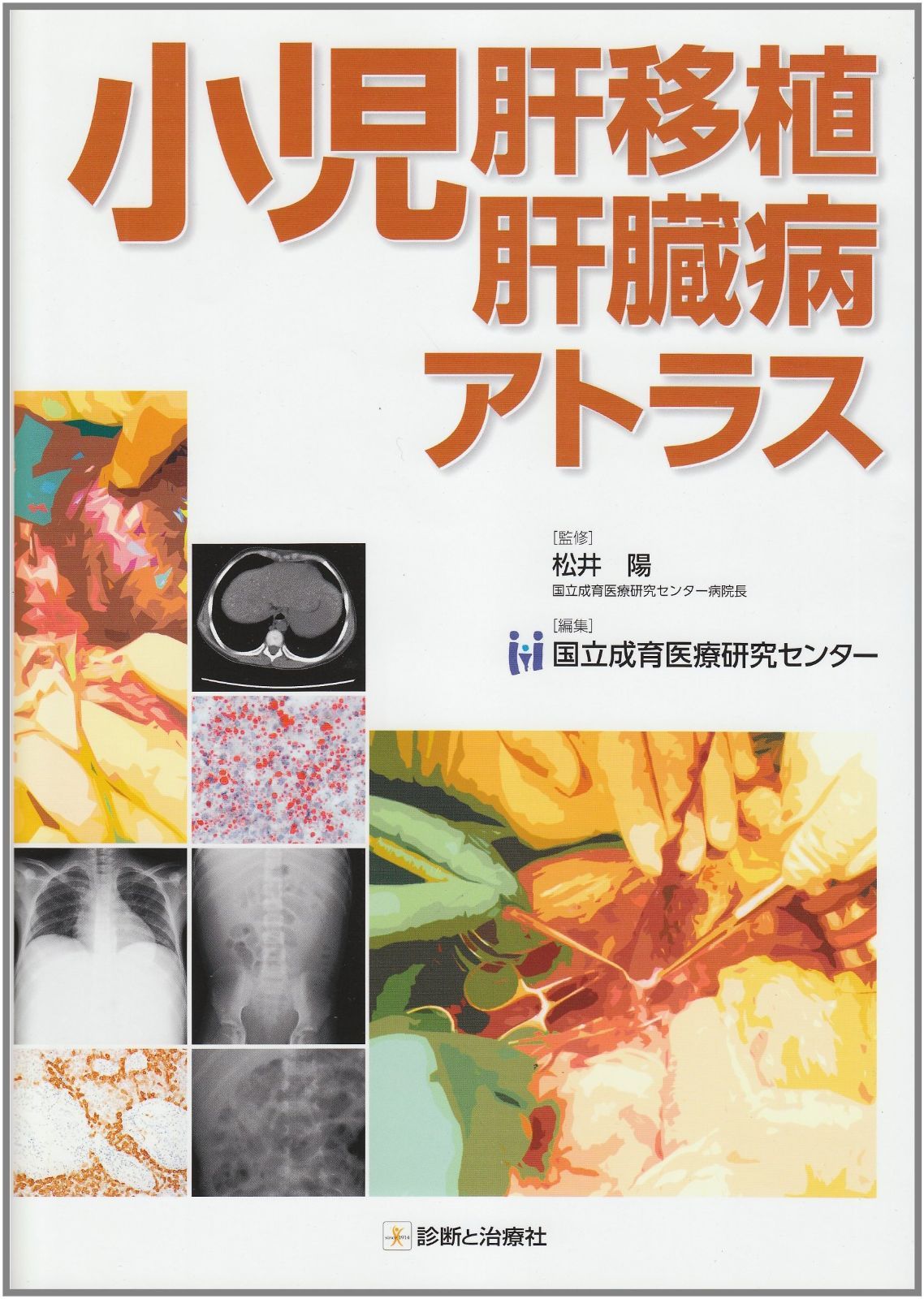 小児肝移植肝臓病アトラス - メルカリ