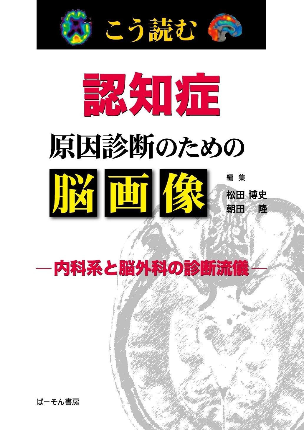 こう読む認知症原因診断のための脳画像: 内科系と脳外科の診断流儀