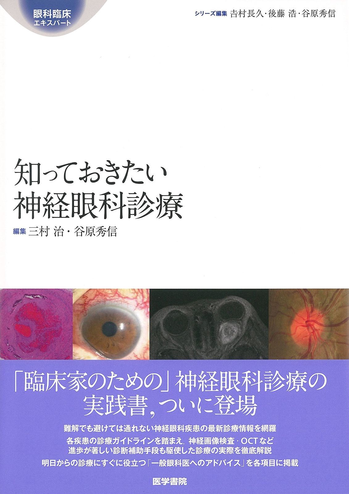 知っておきたい神経眼科診療 眼科臨床エキスパート