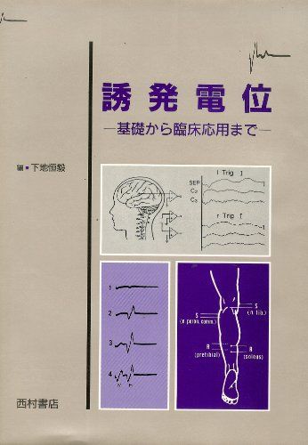 誘発電位―基礎から臨床応用まで 恒毅， 下地 Amazon.co.jp: 誘発電位: 基礎から臨床応用まで : 下地 恒毅: 本