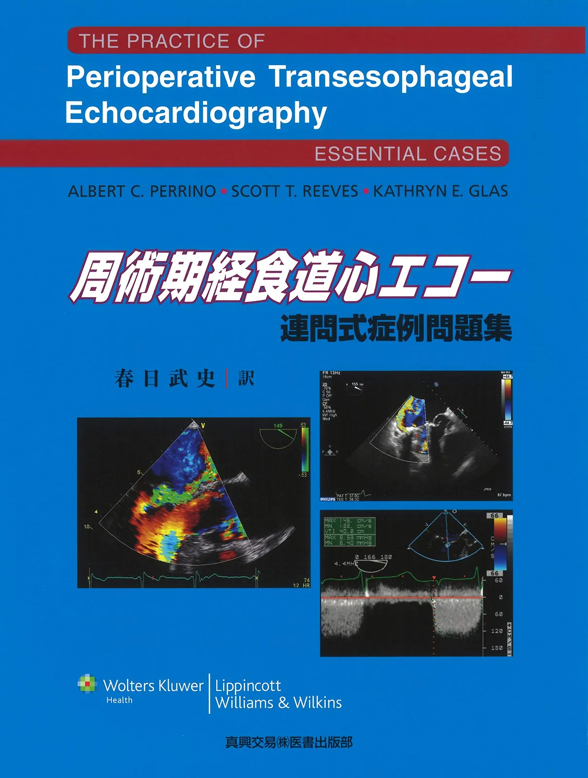 【裁断済】症例別 周術期3D経食道心エコーアトラス 症例別 周術期3D経食道心エコーアトラス | Wei-Hsian Yin, Ming