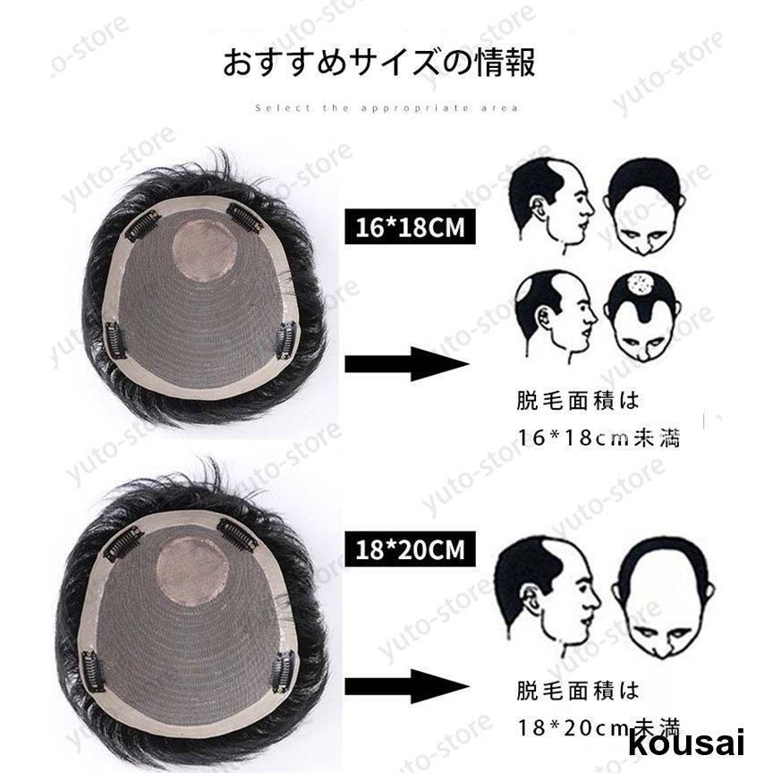 分け目 つむじ
