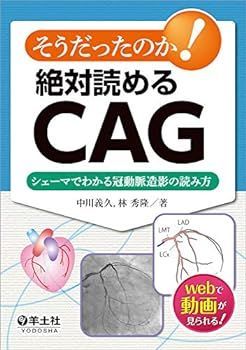 赤字超特価，高品質 【中古】そうだったのか! 絶対読めるCAG?シェーマでわかる冠動脈造影の読み方 中川 義久 その他