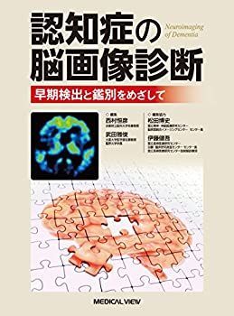 【】 認知症の脳画像診断?早期検出と鑑別をめざして
