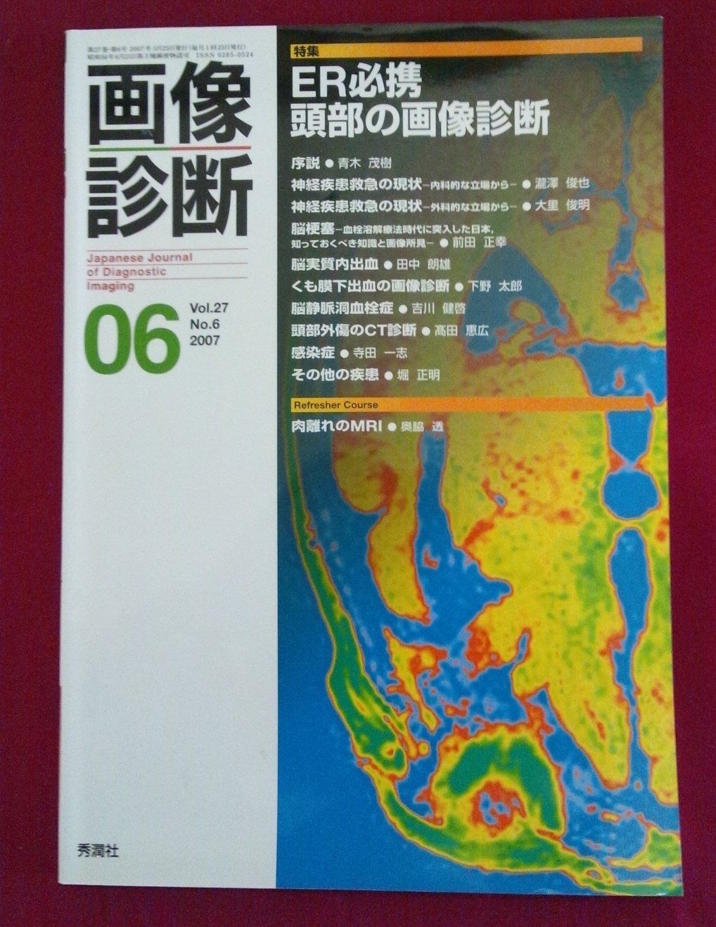 画像診断 2010年〜2016年 ７冊 画像診断 07年6月号 (27-6)