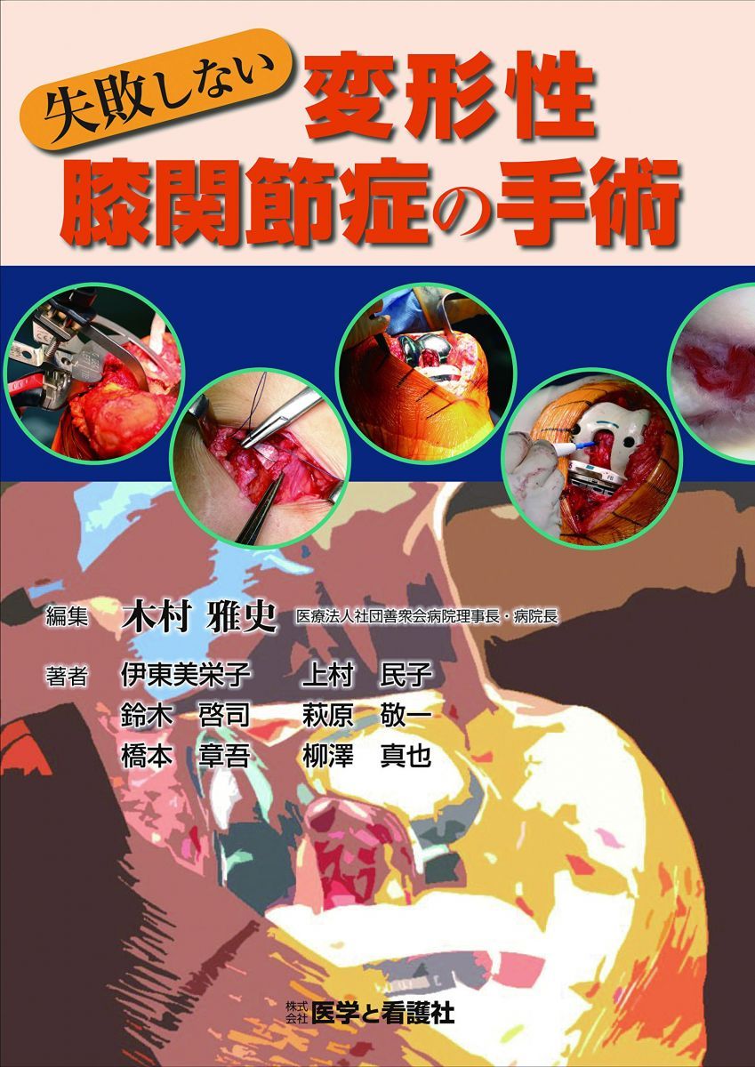 失敗しない変形性膝関節症の手術 伊東 美栄子、 上村 民子、 鈴木 啓司、 萩原 敬一、 橋本 章吾、 柳澤 真也; 木村 雅史 失敗しない変形性膝関節症の手術 伊東 美栄子、 上村 民子