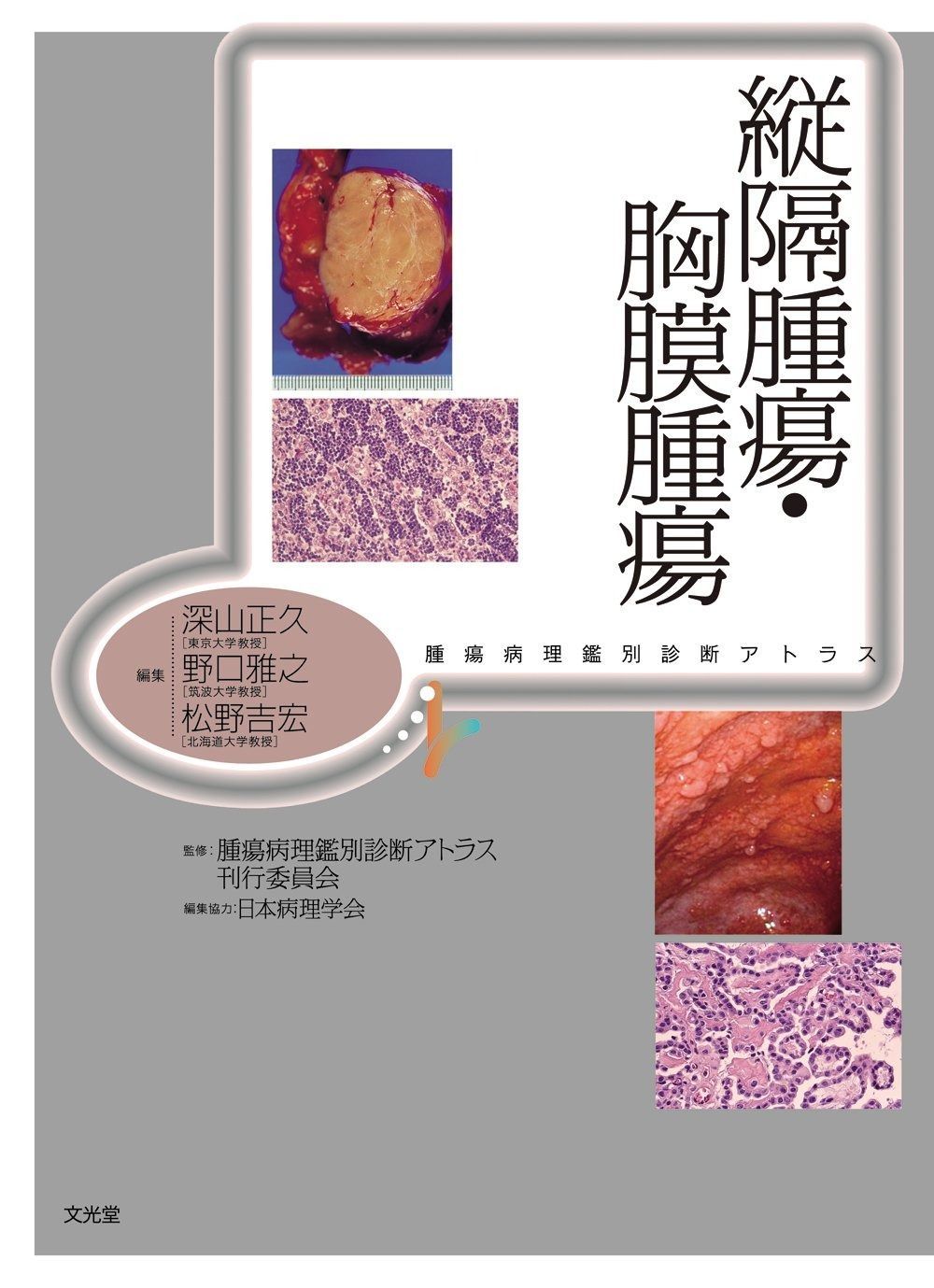縦隔腫瘍・胸膜腫瘍 縦隔腫瘍・胸膜腫瘍 (腫瘍病理鑑別診断アトラス)