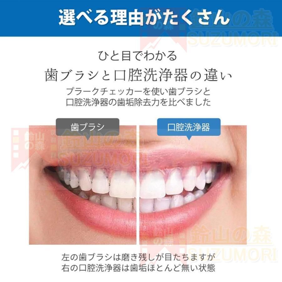 ウォーターピック 歯周ポケット
