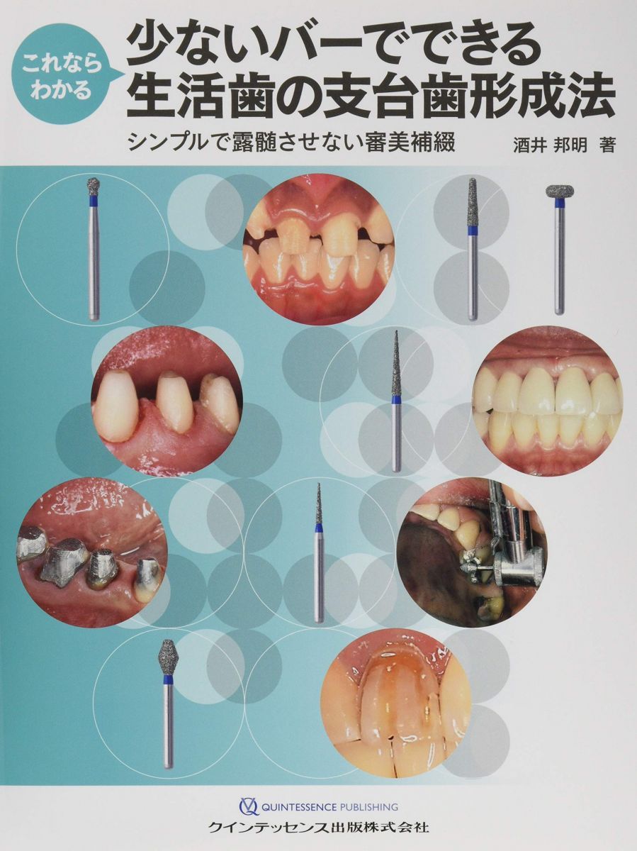 これならわかる 少ないバーでできる生活歯の支台歯形成法