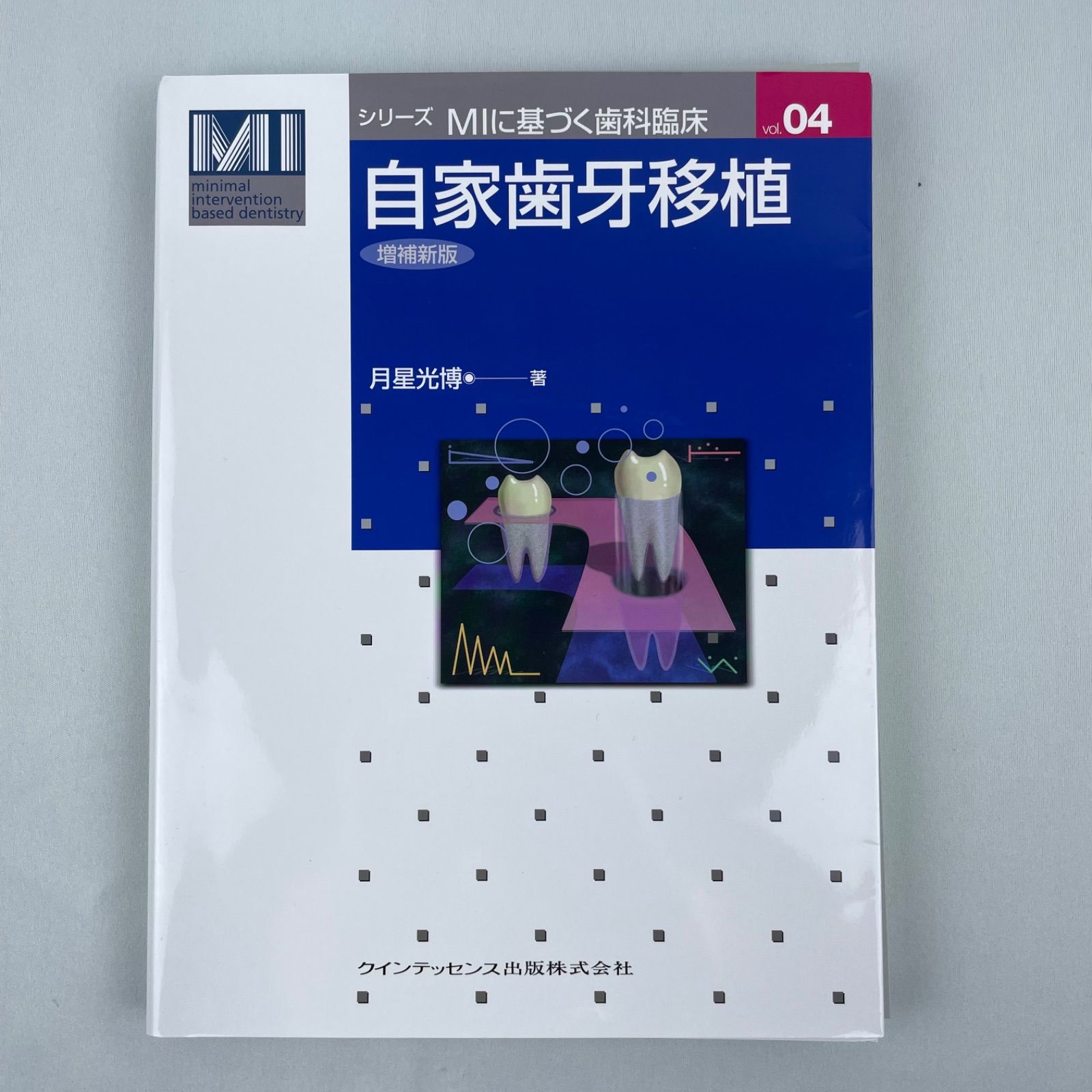 自家歯牙移植\増補新版\ 裁断済
