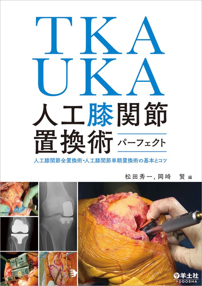 ＴＫＡ ＵＫＡ人工膝関節置換術パーフェクト 人工膝関節全置換術 人工膝関節単顆置換術の基本とコ|羊土社|松田秀一 整形外科学 単行本