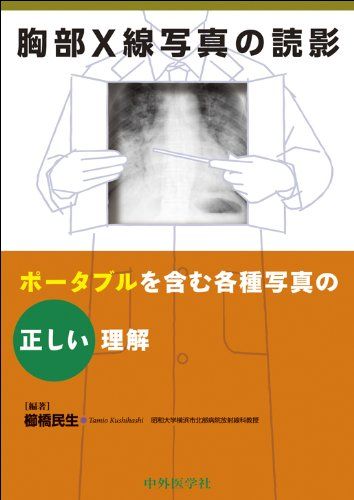 胸部X線写真の読影: ポ-タブルを含む各種写真の正しい理解／櫛橋 民生
