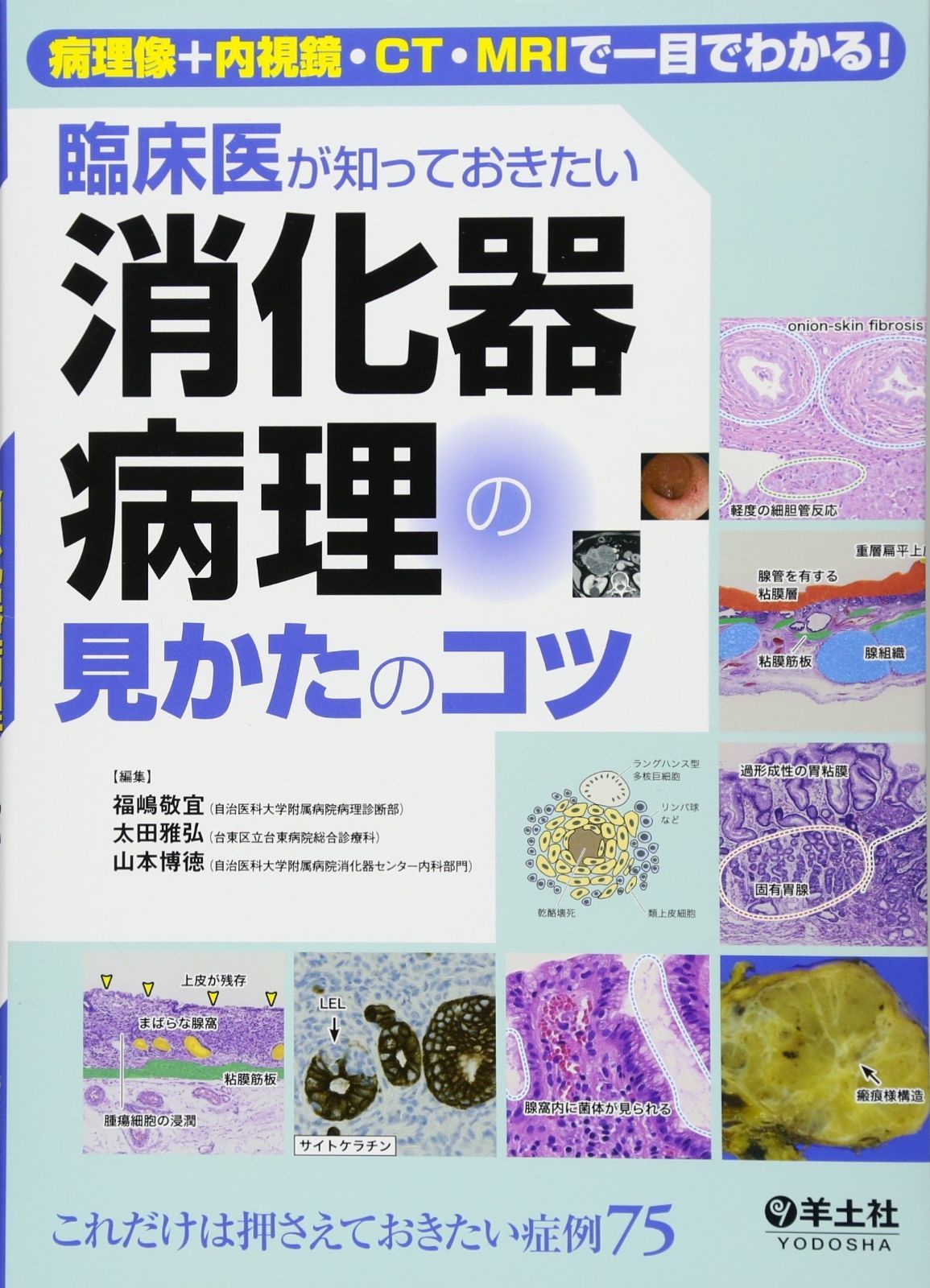 人気，限定SALE 病理像+内視鏡・CT・MRIで一目でわかる! 臨床医が知っておきたい消化器病理の見かたのコツ その他