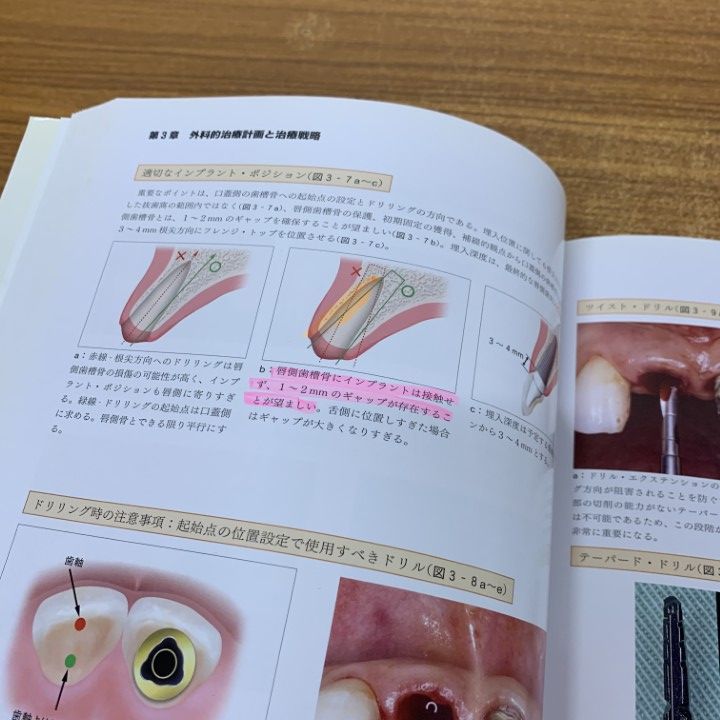 前歯部審美修復 インプラント編　(裁断されていません) 前歯部審美修復 インプラント編 (裁断されていません) 前歯部