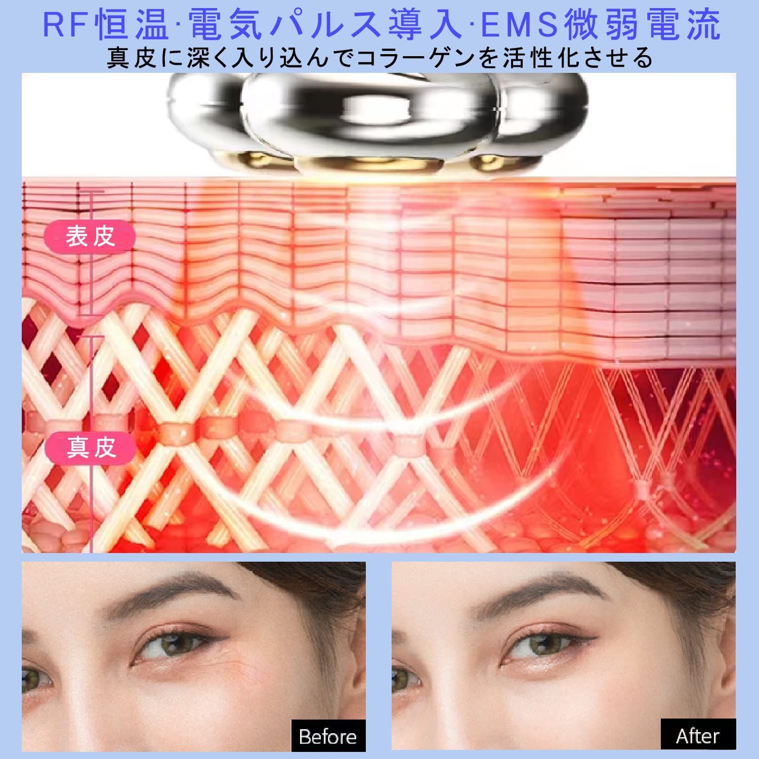 在庫セール】目元ケア 美顔器 RF 目元美顔器 】Vimaydo 電気パルス導入