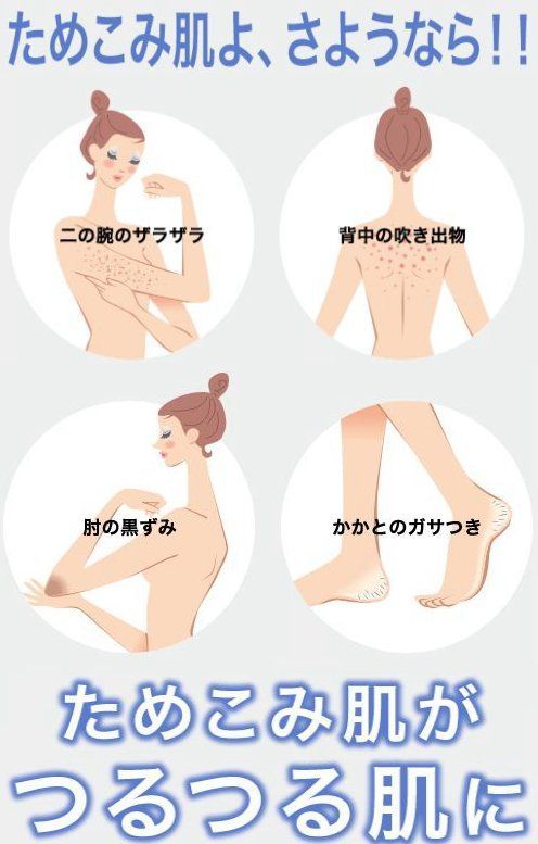 スティミュライト