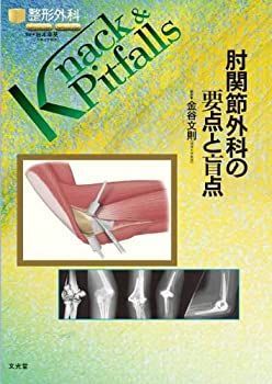 本 手の外科の要点と盲点