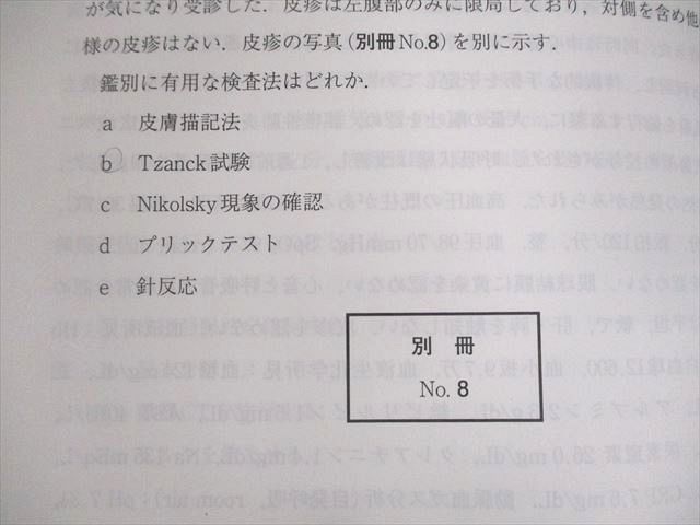 UN28-079 メディックメディア 医師国家試験 第113回 医師国試模試 解説