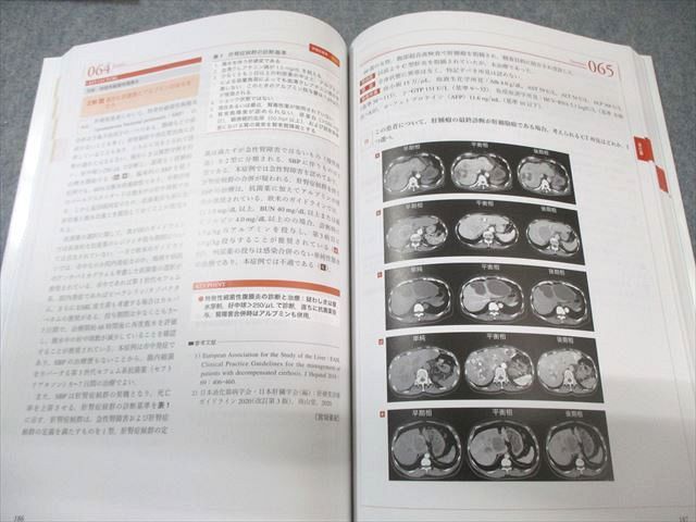 THE 内科専門医問題集 Ver.2 3冊セット　シリアル使用済み 医学書院 THE 内科専門医問題集 Ver.2 1/3 状態良品 2024 計2冊
