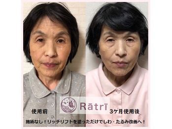 リッチリフト 全身美容液 100g アクシス