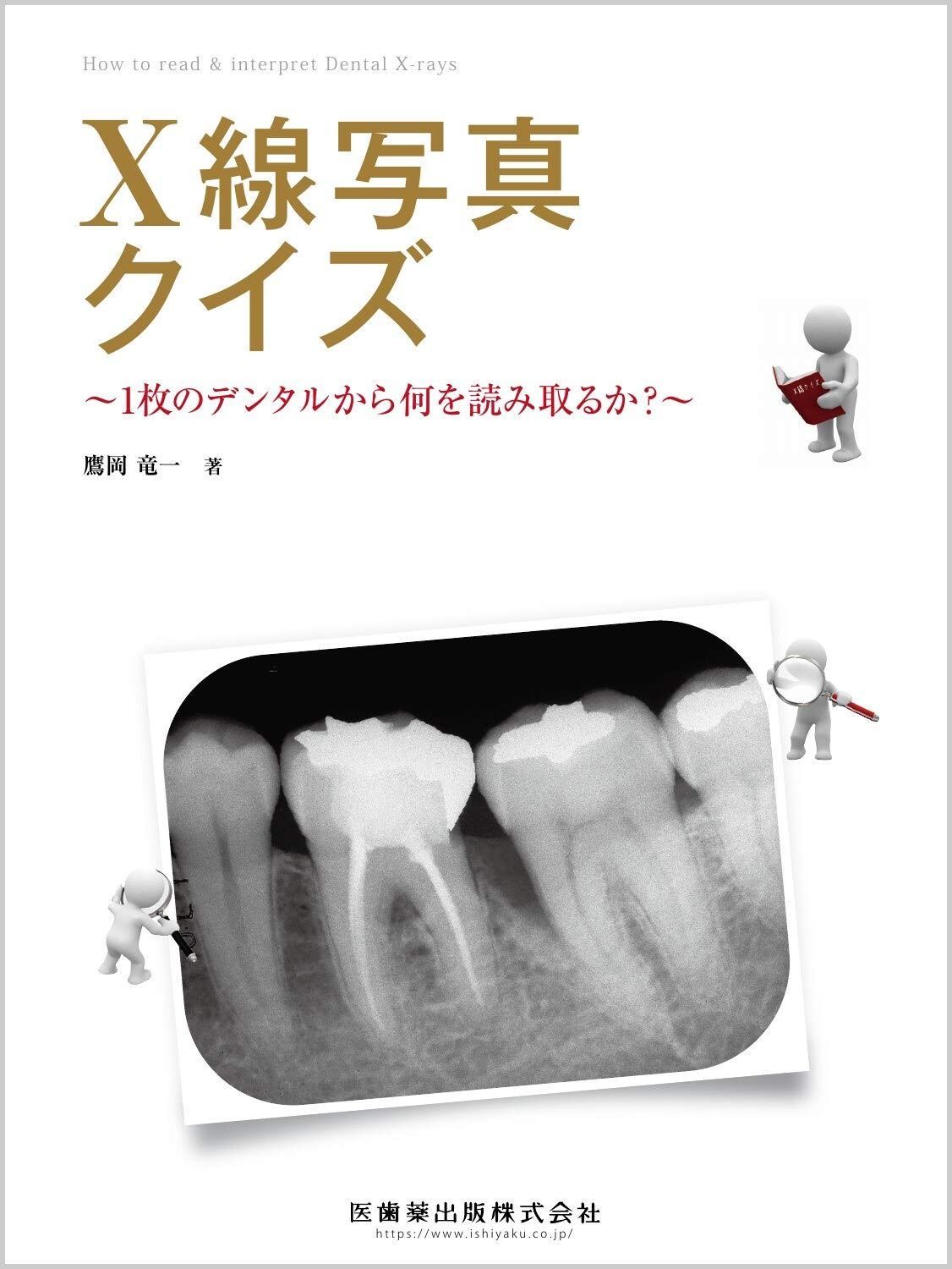 X線写真クイズ 1枚のデンタルから何を読み取るか?
