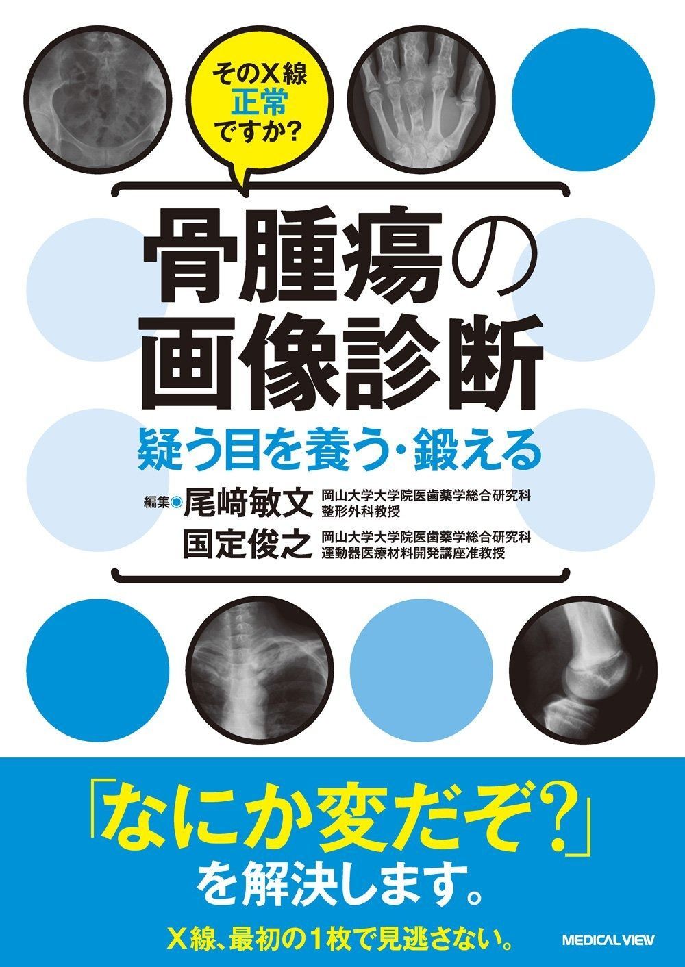 そのX線正常ですか? 骨腫瘍の画像診断?疑う目を養う 鍛える