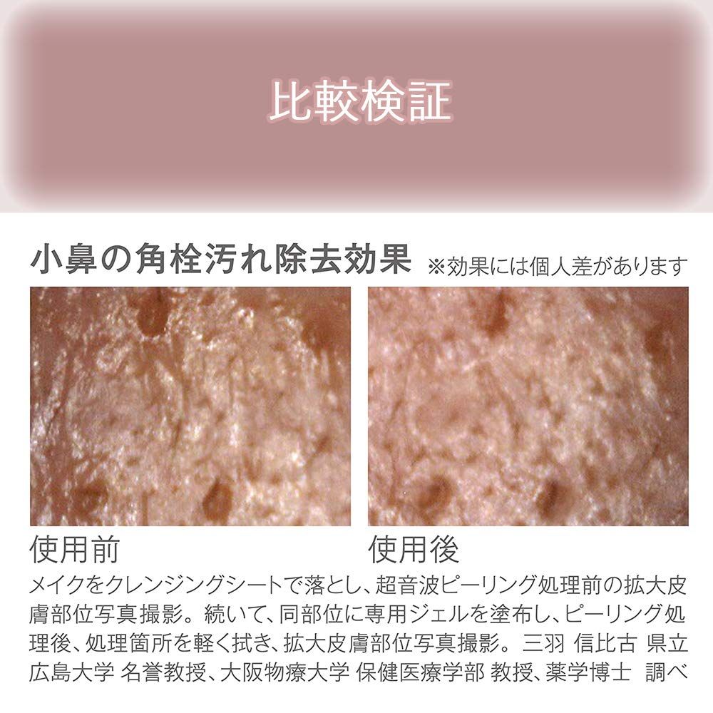 コイズミ 超音波