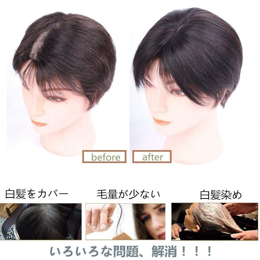 つむじ人工スキン