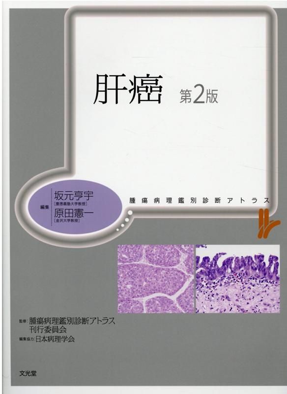 SALE，人気 肝癌第2版 健康・医学