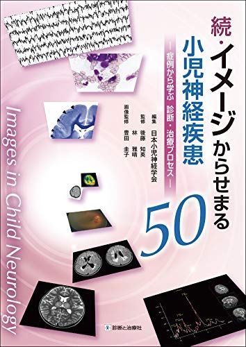続・イメージからせまる小児神経疾患50―症例から学ぶ 診断・治療プロセス― [単行本] 後藤 知英、 林 雅晴、 日本小児神経学会; 豊田 圭子