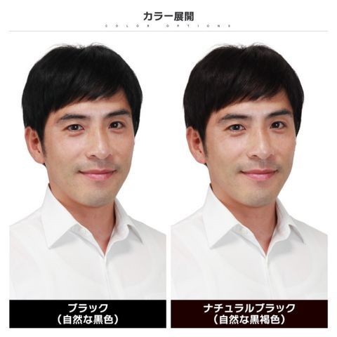 頭頂部 生え際