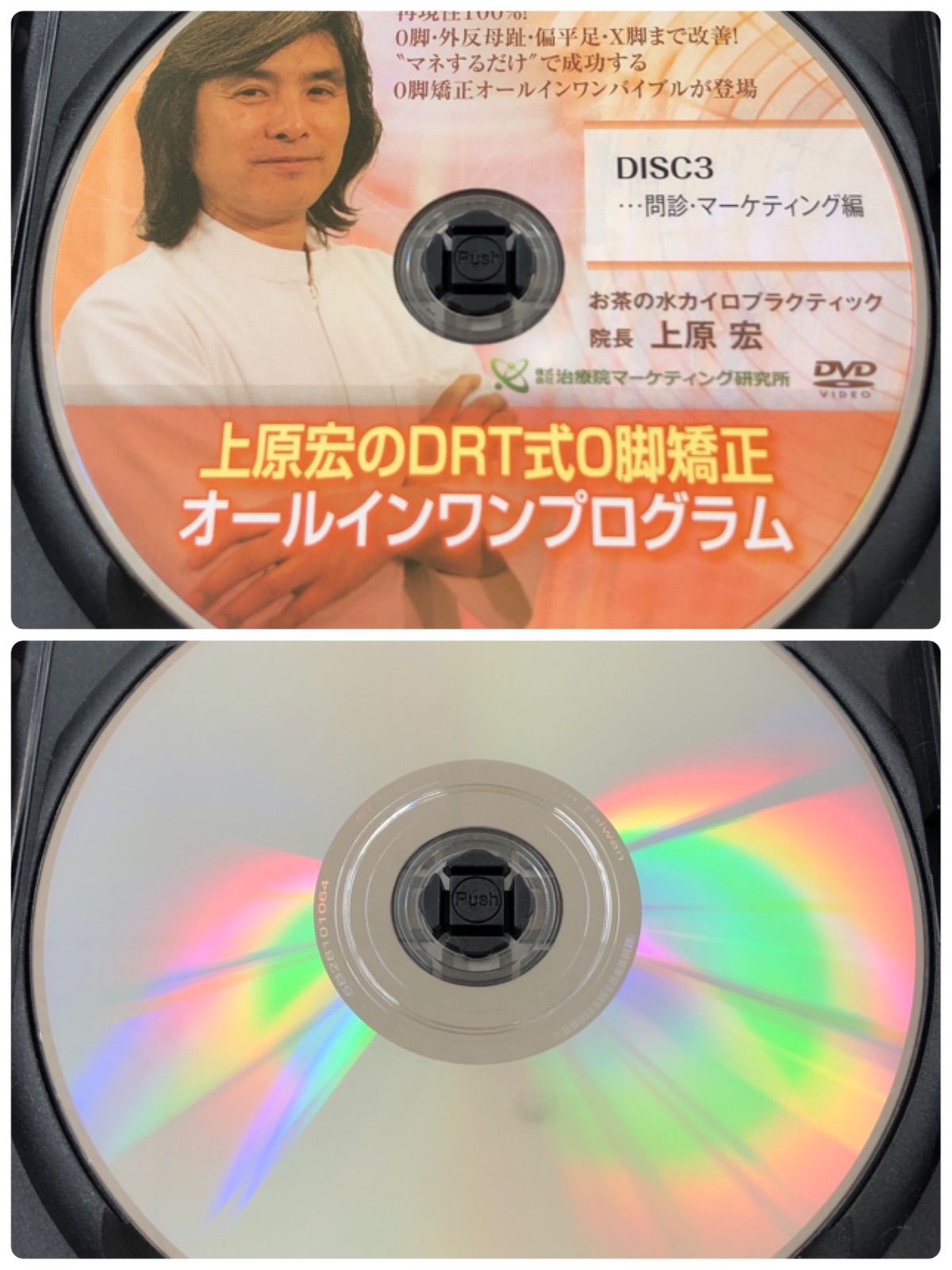 中古DVD】上原宏のDRT式Ｏ脚矯正 オールインワンプログラム （3枚組＋特典ディスク1枚付き）カイロプラクティック 整体 - メルカリ