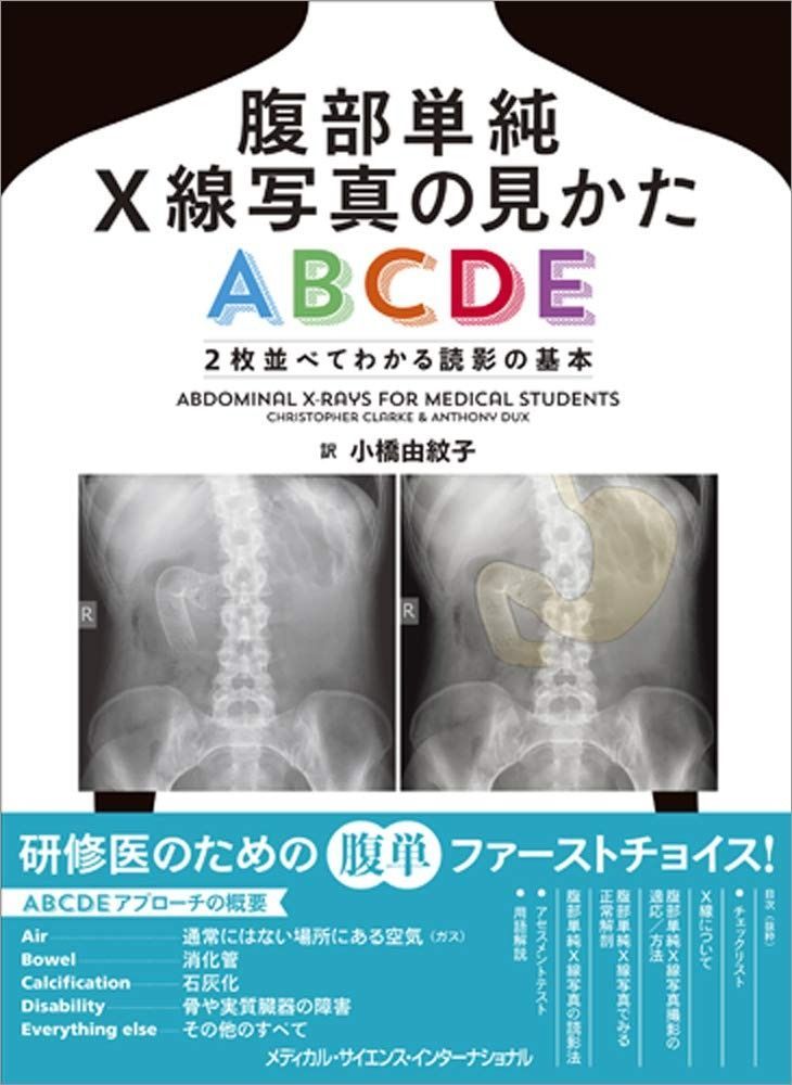 腹部単純X線写真の見かたABCDE 2枚並べてわかる読影の基本