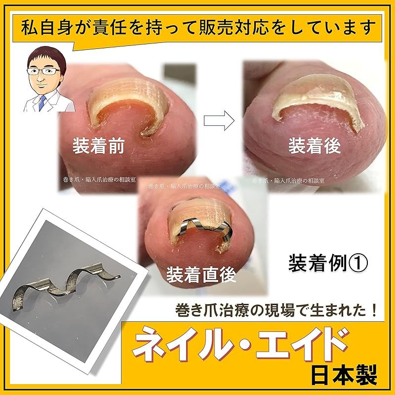 ワイヤー クリップ